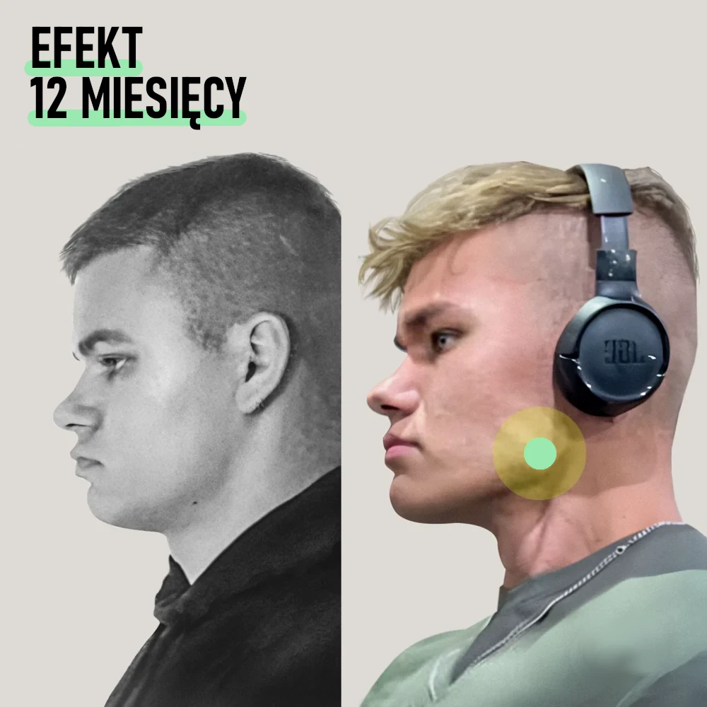 TRENAŻER SZCZĘKI - 20KG